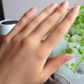 朝に指がむくむ理由は?指のむくみに隠された病気とは? 朝に指がむくむ理由は?指のむくみに隠された病気とは?
