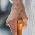 肌老化の原因は加齢だけではないようです。どんな原因があるのでしょう? 肌老化の原因は加齢だけではないようです。どんな原因があるのでしょう?